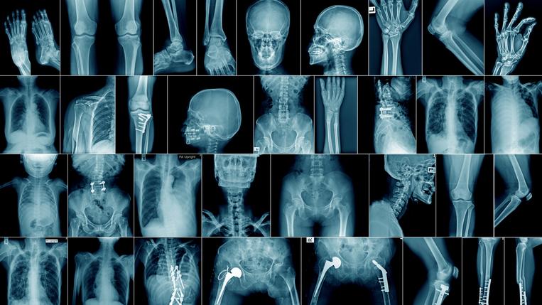 Bác sĩ phẫu thuật trong súp vì cố gắng bán tia X của bệnh nhân dưới dạng NFT - Tin Tức Bitcoin - Cập Nhật Tin Tức Coin Mới Nhất 24/7 2025 Bác sĩ phẫu thuật trong súp vì cố gắng bán tia X của bệnh nhân dưới dạng NFT